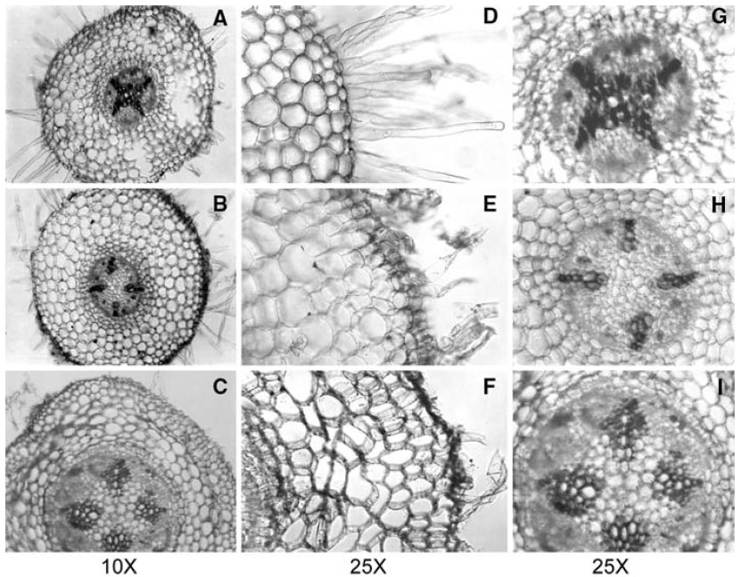 Cross-sections of mung bean roots showing anatomical changes upon exposure to arsenic